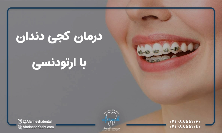 درمان کجی دندان با ارتودنسی