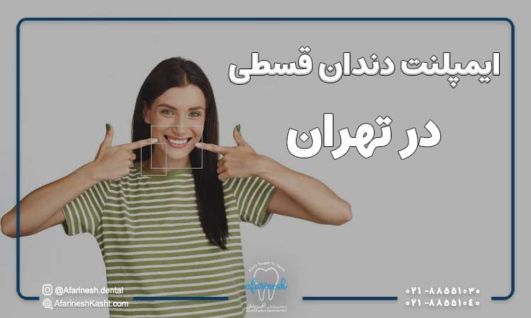 ایمپلنت دندان قسطی در تهران